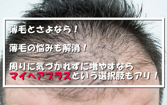 薄毛とさよなら！ 薄毛の悩みも解消！ 周りに気づかれずに増やすならマイヘアプラスという選択肢もアリ！